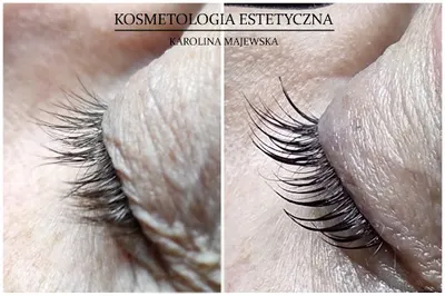 Kosmetologia Estetyczna Karolina Kwiatkowska